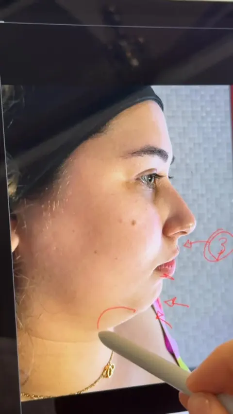 Marcação facial no tablet: a caneta desenha vetores sobre a foto de perfil de uma paciente